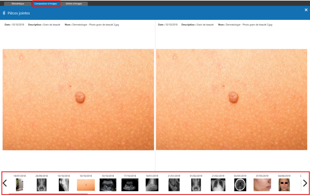 Gérer comparer et annoter les pièces jointes dans le dossier patient