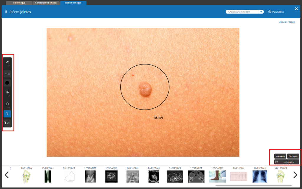 Gérer comparer et annoter les pièces jointes dans le dossier patient